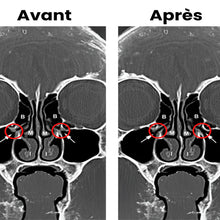 Respirez librement, vivez pleinement,soulagez vos   sinus